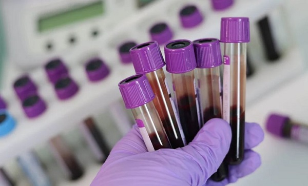 Coronavirus: dal 4 maggio al via i test sierologici sul personale del servizio sanitario piemontese
