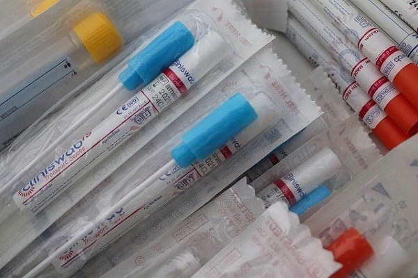 Covid in Piemonte: 28 nuovi casi a fronte di oltre 11mila tamponi. Anche oggi nessun decesso in ospedale